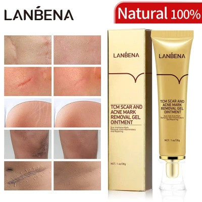 ژل اسکار و ترمیم کننده لانبنا