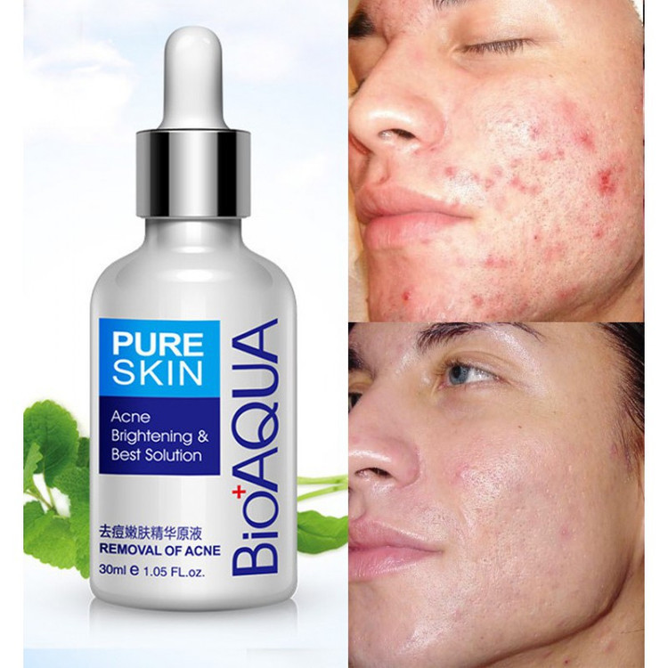 سرم پوست مدل ترمیم کننده جای جوش و ضدجوش 30 میل بیوآکوا BIOAQUA