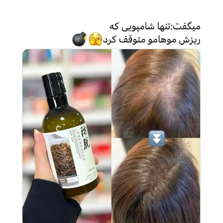 شامپو ضد ریزش مو رزماری Anti-Hair Loss Shampoo
