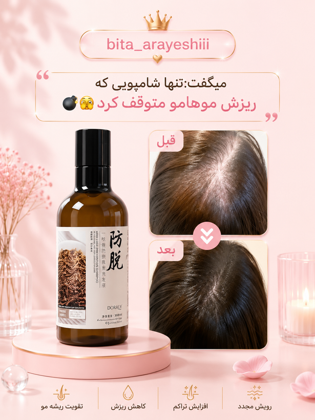 شامپو ضد ریزش مو رزماری Anti-Hair Loss Shampoo